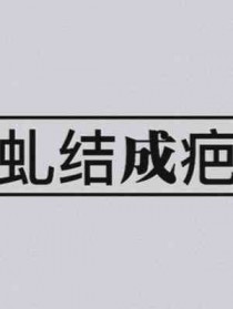 网游之无限秒杀
